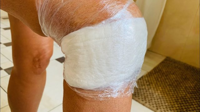 Пчелиный воск: польза и вред, лечение и применение в домашних условиях