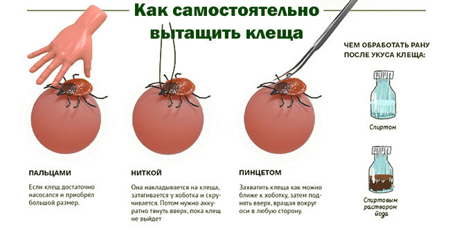 Как удалить клеща с человека 