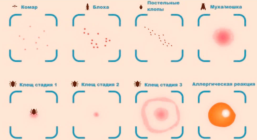 Отличия укусов клещей от укусов других насекомых (сравнение следов укусов) 
